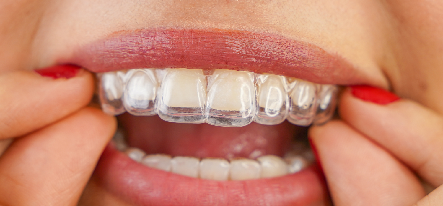 Dentist in Sharjah